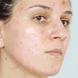 Mild combination skin